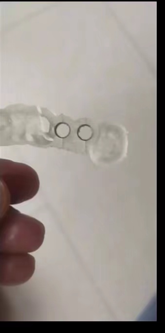 Reçine Diş 3D Yazıcı Dikim Kıl - 3D Printing House Machine incelemesi ve fiyatı